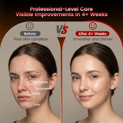 Wireless Red Light Therapy Mask for Face, Anti-Wrinkle & Acne Treatment for Full Face, Chin & Neck, 850nm Infrared Portable LED Face Mask for Home & Travel Use, Ideal Skincare Gifts for Women - Thumbnail 5