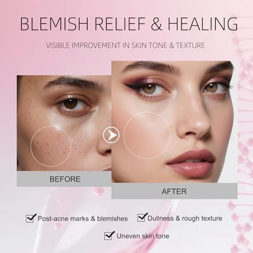 SKSOYT Salmon DNA PDNA Pink Hyaluronic Moisturizing Cream - Lightweight Hydrating Face Moisturizer, Brightening & Elasticity Support, Pore Care - Thumbnail 3