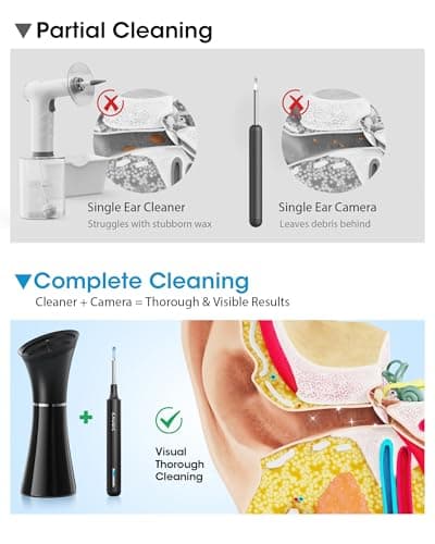 Ear Wax Removal Kit with Camera – Ear Cleaner Tool for Safe & Effective Ear Care – Includes Ear Camera for Visual Inspection & Gentle Ear Irrigation System – Complete Ear Cleaning Solution - Thumbnail 3