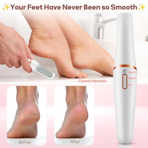 ZABOUL Electric Foot Callus Remover Rechargeable Portable Electric Foot File Pedicure Tool Kit, Smooth Pedicure Wand for Feet Care, Removes Dry Hard & Dead Skin, Ideal Gift - Thumbnail 3