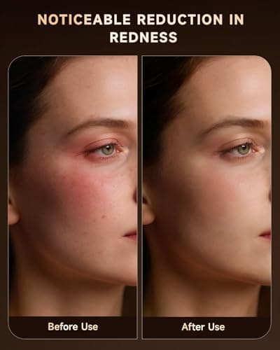 Red Light Therapy Mask for Face, 4 Modes Wireless Remote LED Face Mask Light Therapy, 850nm Near-Infrared & Red Light, 272 LEDs, Anti-Aging Skin Rejuvenation Device for Home or Travel Gift for Women - Thumbnail 6