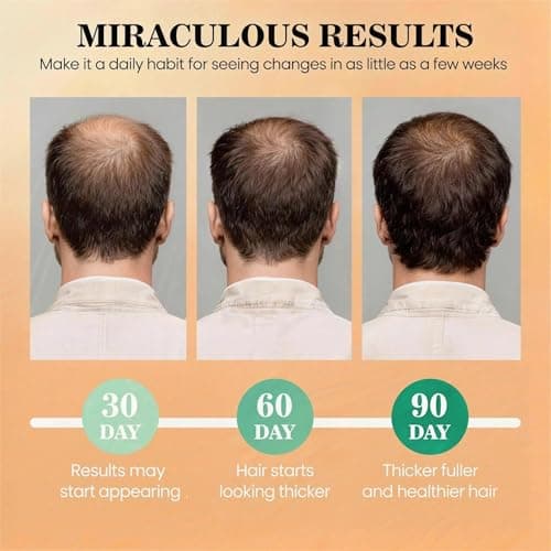 Batana Oil for Hair Growth Dr Sebi, 100% Raw Organic Batana Hair Mask from Honduras, Wild Growth Hair Oil, Scalp Oil Promotes Hair Thickness, Prevents Loss for Men & Women, 4.06 fl oz - Thumbnail 4