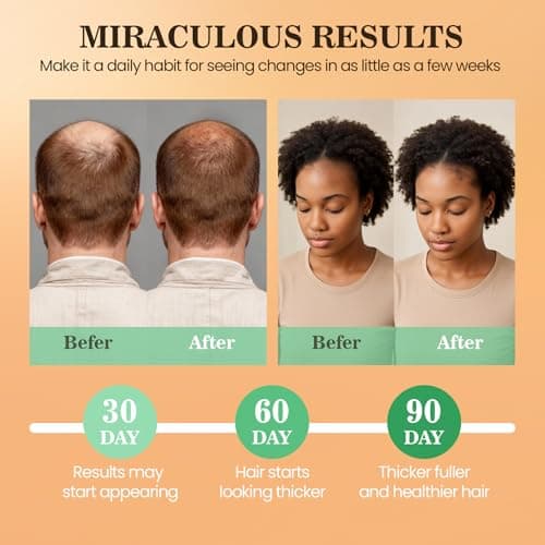 Batana Oil for Hair Growth Dr Sebi, 100% Raw Organic Batana Hair Mask from Honduras, Wild Growth Hair Oil, Scalp Oil Promotes Hair Thickness, Prevents Loss for Men & Women (4.06 Fl Oz, Nutmeg) - Thumbnail 4