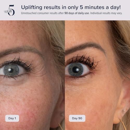 upLift 5 Pulsating Facial Lift | 5 Minute Age Reversal Device, Contours & Improves Facial Structures, Tightening & Toning of Skin - Thumbnail 3