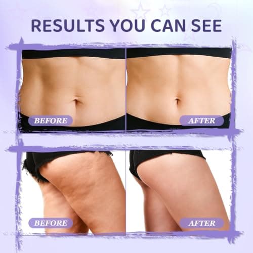 MYTH-Dreamy Overnight Toning Whip Firming Cellulite Cream, Skin Firming and Tightening Lotion While You Sleep - Helps Tighten Loose Skin & Cellulite on Body Belly Booty Arms Thighs with Gua Sha Tool - Thumbnail 4