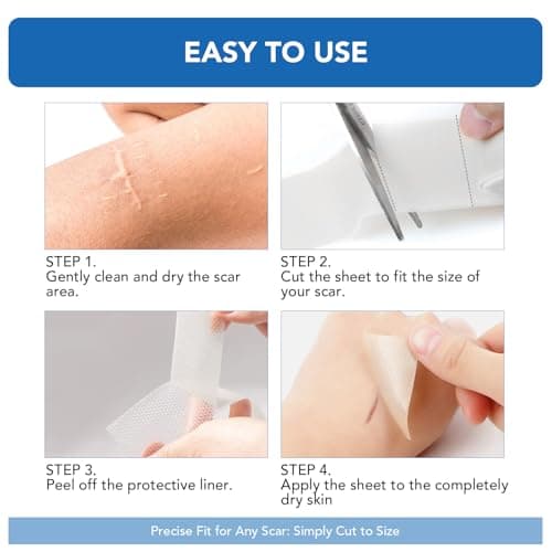 Clear Silicone Scar Sheets, Silicone Scar Tape(1.6"x 60" Roll-1.5M) - Reusable, Soft & Medical Grade Adhesive Tape for Old & New Scars, C-Section, Surgery, Keloid & Acne Scars - Thumbnail 4