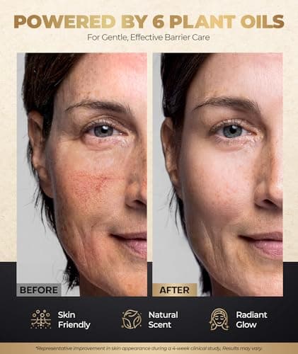 GOWILOVE 12Hr Moisture Lock Beef Tallow for Skin Care, Instant Redness Eraser Tallow and Honey Balm with 6 Botanical Rescue, Dewy Not Oily Face Cream Moisturizer Gift for Women Eczema Rosacea 3.04 Oz - Thumbnail 3