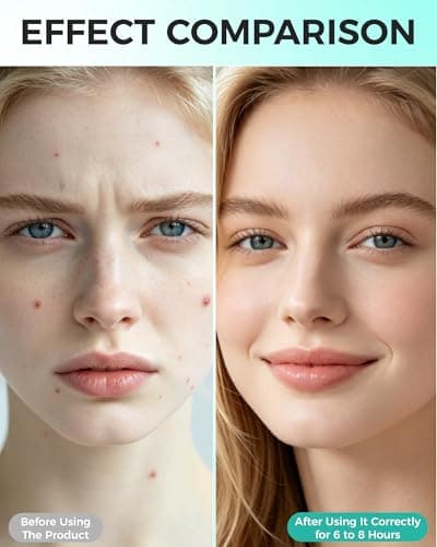 Pimple Patches for Face, 36ct Microdart Acne Patches, Microdart Pimple Stickers for Covering Zits & Blemishes, Self-Dissolving Microneedle Patches with Salicylic Acid, Hydrocolloid Facial Patches - Thumbnail 6