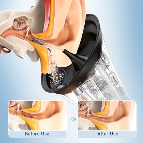 Electric Ear Wax Removal System, Water Powered Ear Cleaning Tool with Irrigation Flusher, 6 Tips, 4 Pressure Settings - Safe & Effective for Ear Wax Buildup Flushing and Cleaning - Thumbnail 2