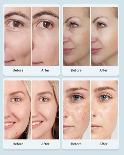 MIBIITTY Beauty Led Mask, Led Face Mask Light Therapy - Thumbnail 6