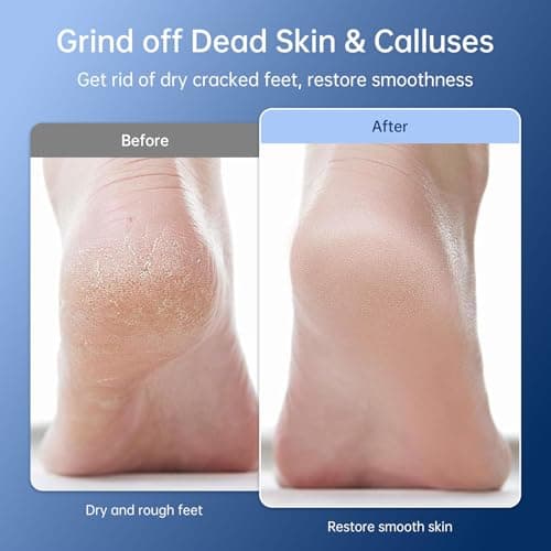 Electric Callus Remover for Feet - Rechargeable Foot Sander, 6 Speeds, Replaceable Sandpaper Professional Foot Grinder, Cordless Electric Foot File Pedicure Tools for Dead Skin, Cracked Heels - Thumbnail 4
