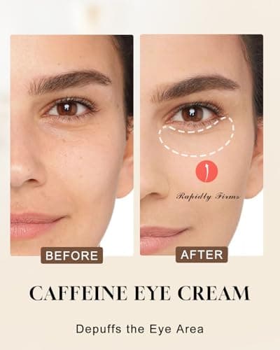 TJE Caffeine Eye Cream, Under Eyes Cream with Hyaluronic Acid & Vitamin E, Under eye Treatment Serum for Women & Men - 15 g - Thumbnail 2