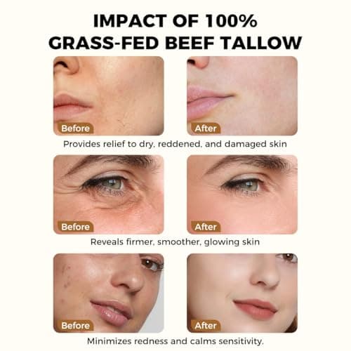 Lopeie Beef Tallow for Skin - Organic Grass Fed Whipped Moisturizer with Honey Balm, Natural Hydrating Cream for Face & Body, Relief for Dry & Sensitive Skin (4.23oz, Unscented) - Thumbnail 5