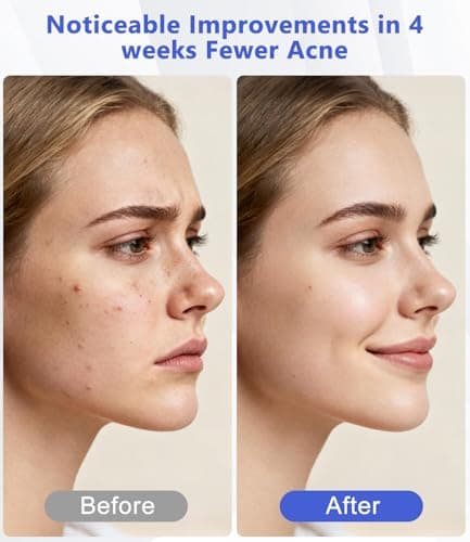 LED Light Therapy Machine FDA Cleared Red, Infrared and Blue Light Therapy, LED Face Mask Light Therapy Skin Care Photon Device for Wrinkle Reduction and Acne, G3 - Thumbnail 3