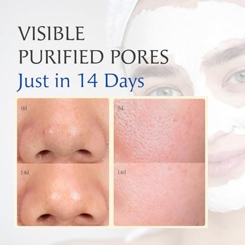 Deep Pore Cleansing Clay Mask for Face, Mud Mask for Oily Skin, Blackhead Mud Facial Mask - with Bentonite and Amazonian White Clay - Oil Control, Niacinamide Brightening, Pore Purifying, 100g - Thumbnail 2