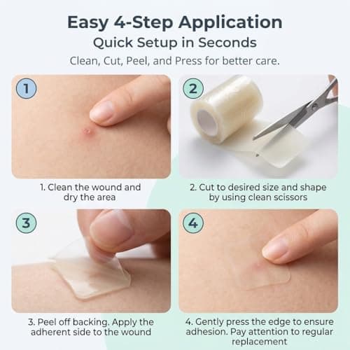 Medical Grade Hydrocolloid Roll for Wound Care with Edges,Hydrocolloid Tape Waterproof Pimple Patches Tape Absorbent Large Hydrocolloid Patch for Acne Patches,Blisters,Burns,Bed Sore and Minor Cuts - Thumbnail 5