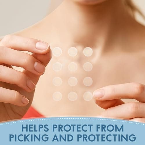Zovira Invisible Pimple Patches (36 Count) – Ultra Thin Hydrocolloid Acne Patch for Daytime, Tapered Edges, Helps Reduce Redness in 15 Min, For Sensitive Skin - Thumbnail 5