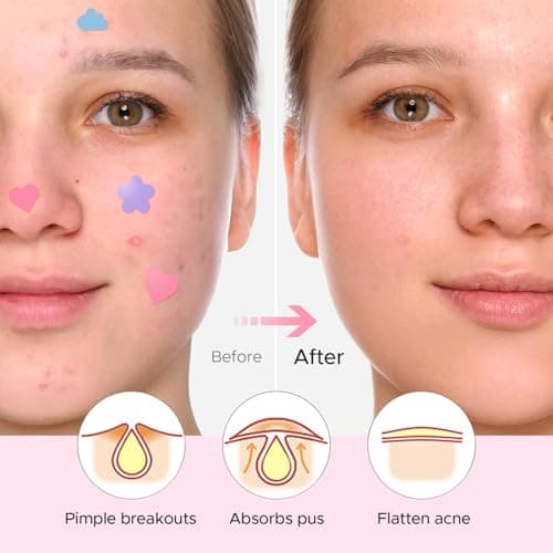 LitBear Acne Pimple Patch, 360 Dots 3 Shaped Colors Pimple Patches with Salicylic Acid, Tea Tree Oil & Calendula Oil, Hydrocolloid Acne Patch for Face, Blemish, Cute Zit Patch Pimple Sticker Acne Dots - Thumbnail 6