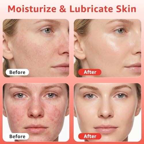 Red Light Therapy Serum, Red Light Therapy Activation Serums Amplify Effects & Reduce Wrinkles with Hydrating, Vitamin E Redlight Serum for Face, Rose Extract Facial Serums for Women, 1.0 FL.OZ - Thumbnail 2