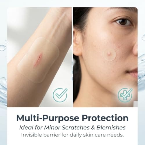 Medical Grade Hydrocolloid Roll for Wound Care with Edges,Hydrocolloid Tape Waterproof Pimple Patches Tape Absorbent Large Hydrocolloid Patch for Acne Patches,Blisters,Burns,Bed Sore and Minor Cuts - Thumbnail 3