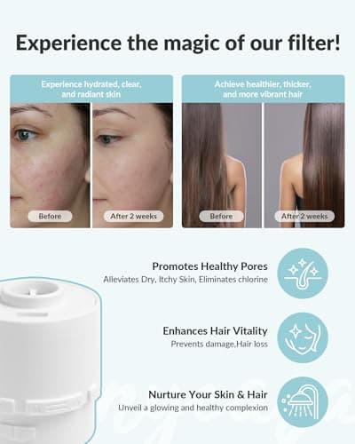 SANYCASA Filtered Shower Head for Hard Water, Removes Chlorine & Heavy Metals, KDF-55 Filter for Healthier Hair & Skin, Protects Colored Hair, High Pressure, Dermatologist Recommended(BNP) - Thumbnail 4