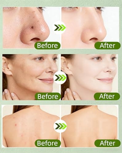 TZUNAKI Bee Venom Cream - 2 Packs Ampoule Firming Cream for Joint Long-Lasting Hydrating for Face Whole Body Strength Muscle, Natural Bee Wax Honey Lotion Gentle Formula for All Skin Types Men Women - Thumbnail 4