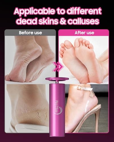 HayZBao FSA&HSA Electric Foot Callus Remover - Callus Remover for Feet,Professional Pedicure Tool for Dead Skin,Electric Foot File with 60 Pcs Sandpaper Discs - Pink - Thumbnail 6