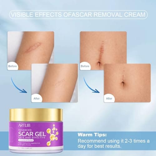 ARTLIB Scar Cream,Silicone Scar Gel,Helps Reduce Surgical Scars,Acne,Burn,Keloids Bump,Stretch Marks, Advanced Scar Removal Cream for Old and New Scars(1.69oz) - Thumbnail 4