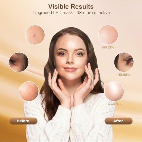 AIUO Red Light Therapy for Face, LED Face Mask Light Therapy, Rechargeable Red Light Therapy Mask for Face with Comfortable Light-Blocking Eye Protection & Timing Function At Home, Black - Thumbnail 3