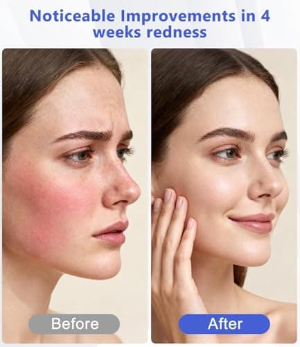 LED Light Therapy Machine FDA Cleared Red, Infrared and Blue Light Therapy, LED Face Mask Light Therapy Skin Care Photon Device for Wrinkle Reduction and Acne, G3 - Thumbnail 4