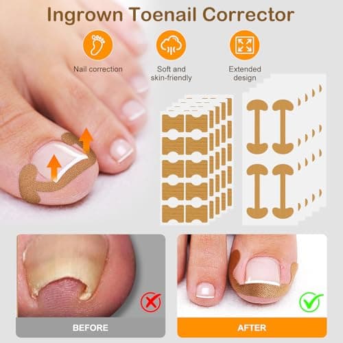 Ingrown Toenail Corrector Set with Correction Strips, Ingrown Toenail Removal Kit, Professional Ingrown Toenails Pedicure Tool Set (Silver) - Thumbnail 4