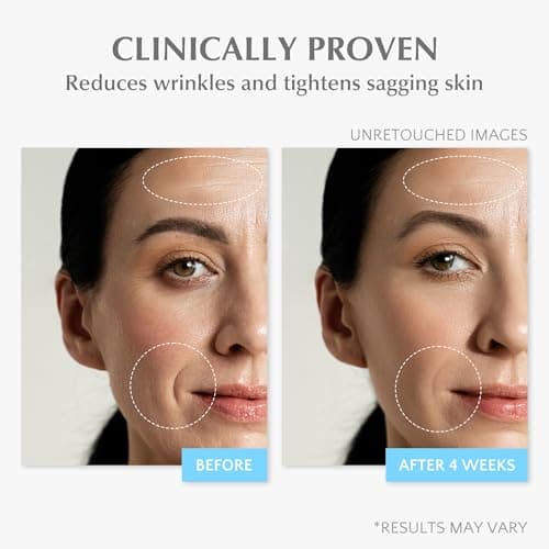 EnaSkin Retinol Collagen Face Cream: Wrinkle Cream for Women, Neck & Décolleté Anti Aging Moisturizer with 7% Hyaluronic Acid Serum - Day/Night Skin Firming & Tightening, 1.7 Oz - Thumbnail 5