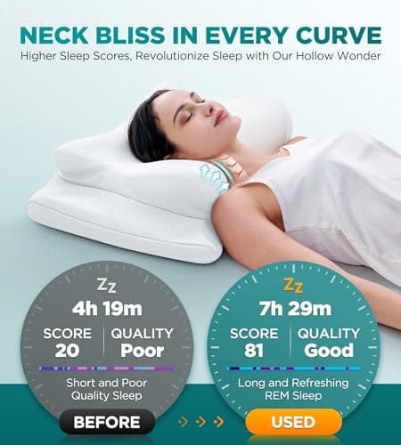 EKIFT Ease Now Cervical Neck Pillow for Pain Relief, Beauty Sleeping Cooling Pillow for Side Back Stomach Sleeper, Odorless Memory Foam Bed Pillows Deep Sleep,Ergonomic Orthopedic Neck Support - Thumbnail 2