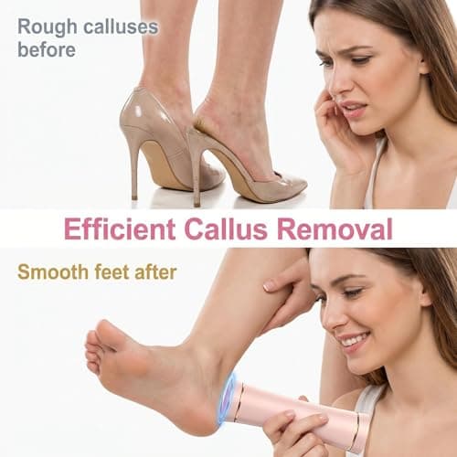 DIYIXULIE Electric Callus Remover, Rechargeable Foot File Home Use - Thumbnail 5