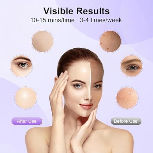 XANBYYE Red Light Therapy for Face,Red Light Mask for Anti-Aging, LED Face Mask Light Therapy Adjustable Brightness with 7-Color LED Facial Mask, Rechargeable Light Care Beauty Device for Home Use - Thumbnail 2