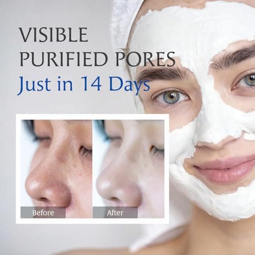 Deep Pore Cleansing Clay Mask for Face, Mud Mask for Oily Skin, Blackhead Mud Facial Mask - with Bentonite and Amazonian White Clay - Oil Control, Niacinamide Brightening, Pore Purifying, 100g - Thumbnail 5