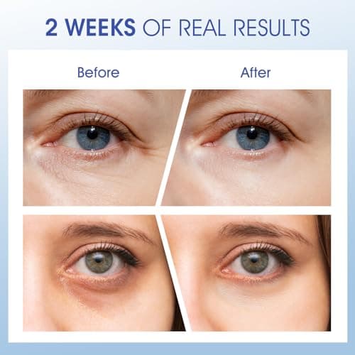 ceedoo Eye Cream for Wrinkles, Fine Lines & Crows Feet - With Ceramides, Peptides + Caffeine + Niacinamide - Anti Aging Skin Renewing Under Eye Cream for Men and Women, 0.5 Oz - Thumbnail 3