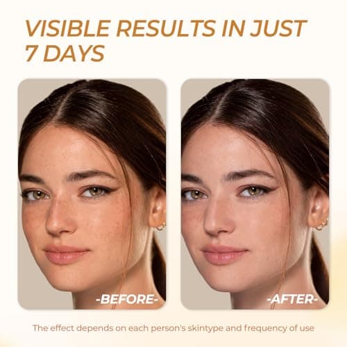 FIUMOT Deep Vitamin C Golden Capsule Hydrating Face Moisturizer, Antioxidant Protection, Lightweight Daily Skincare - Thumbnail 4