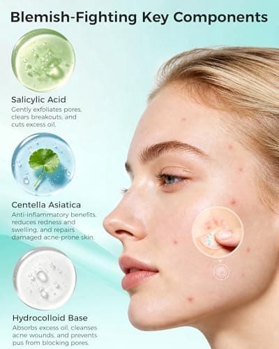 Pimple Patches for Face, 36ct Microdart Acne Patches, Microdart Pimple Stickers for Covering Zits & Blemishes, Self-Dissolving Microneedle Patches with Salicylic Acid, Hydrocolloid Facial Patches - Thumbnail 3