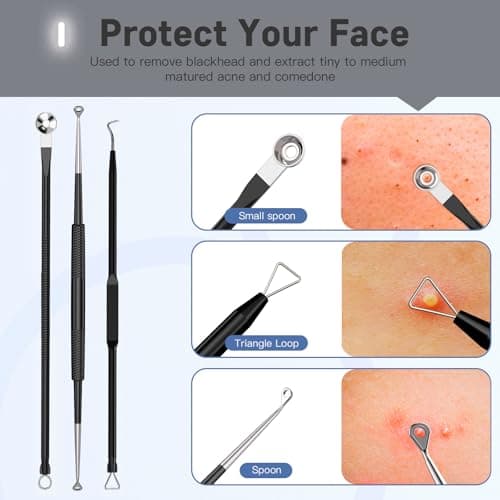Professional Pimple Popper Tool Kit,10 PCS Blackhead Remover Tweezers,Extractor Acne Removal Kit for Easy Removal for Pimples,Comedone Extractor Tools for Removing Zit,Acne Removal Kit (Black) - Thumbnail 2