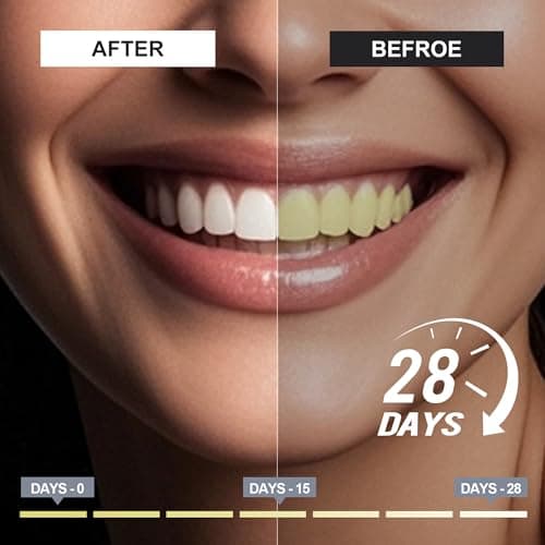 woadee 7.5% Hydroxyapatite Toothpaste for Advanced Enamel Protection, Fluoride-Free Nano Hydroxyapatite Toothpaste, Gentle and Effective Formula, Fresh Breath, Suitable for Sensitive Teeth 2 Pack - Thumbnail 2