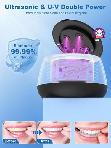 KUNPHY Ultrasonic Retainer Cleaner Machine, 48kHz Dental Cleaning Pod for Braces, Night Guard, Mouthguard, Toothbrush, Denture, Jewelry Black - Thumbnail 3