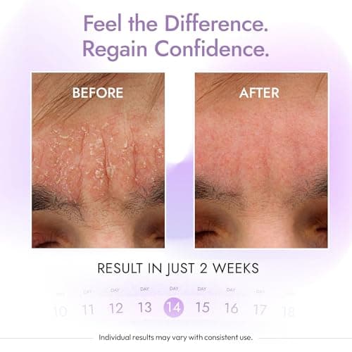 DERMAdoctor Seborrheic Dermatitis Shampoo – 2% Pyrithione Zinc Face Wash, Dermatologist Formulated Anti Dandruff Shampoo for Women, Itchy Scalp Treatment for Hair, Beard, Face & Body – 7.10 oz - Thumbnail 4