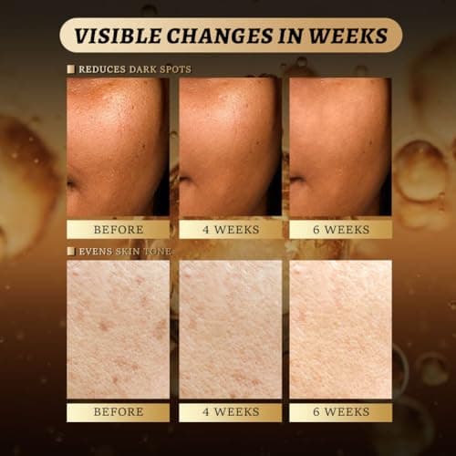Individually Sealed Turmeric Kojic Acid Cleansing Pads - Stays Fresh, Hygienic! (20 Pads) - Gentle Brightening Exfoliator for Dark Spots & Hyperpigmentation, Travel-Size - Thumbnail 3