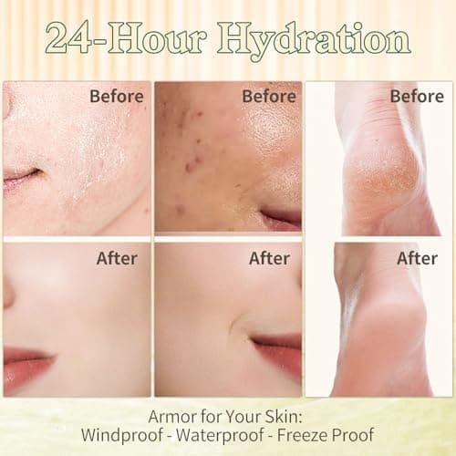 Whipped Beef Tallow Balm for Skin - 100% Organic Grass-Fed Tallow & Honey Body Butter, Infused with Olive Oil to Nourish, Soothe & Repair Dry, Cracked, Sensitive Skin- Natural Deep Moisturizer 4 OZ - Thumbnail 4