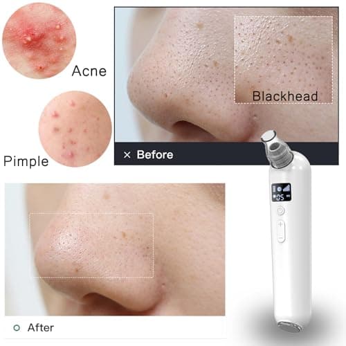 Vacuum Blackhead Remover Pore Cleaner with Heat & Red Light 5 Suction Levels Nose Pore Cleaner Rechargeable with LED Display, 6 Probes & Bonus Blemish Extractor Tools, Skincare Gift for Women - Thumbnail 2