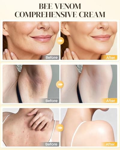 GAJUANR Bee Venom Moisturizing Cream, All-in-One Nourishing Moisturizer with Hyaluronic Acid, Firming & Hydrating Face and Body Cream, Natural Gentle Formula for All Skin Types (60g * 2PCS) - Thumbnail 4