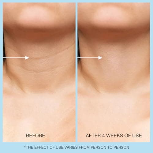 UJhay Retinol Neck Cream, Hyaluronic Acid and Caffeine Enriched Neck Firming Cream to Minimize Fine Lines & Dullness - 3-in-1 Moisturizing Cream for Neck, Chest and Face (50 ml/1.7 oz) - Thumbnail 5