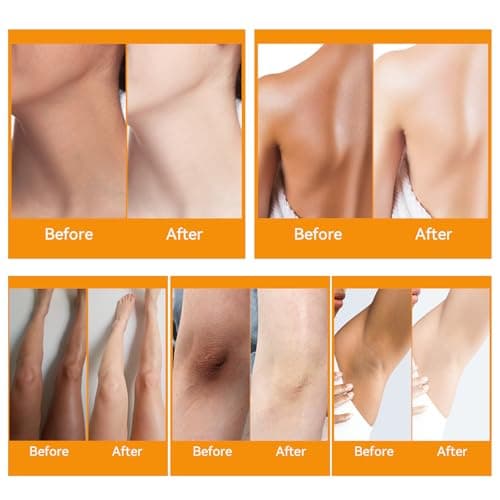 YAFUSIPE Dark Knuckle Remover Underarm Cream Body Moisturizer Lotion Dark Toe Knuckle Treatment Removal Corrector for Armpit Knees Elbow Inner Thigh Neck Private Part Intimate Skin Cream 4.21floz/120g - Thumbnail 3