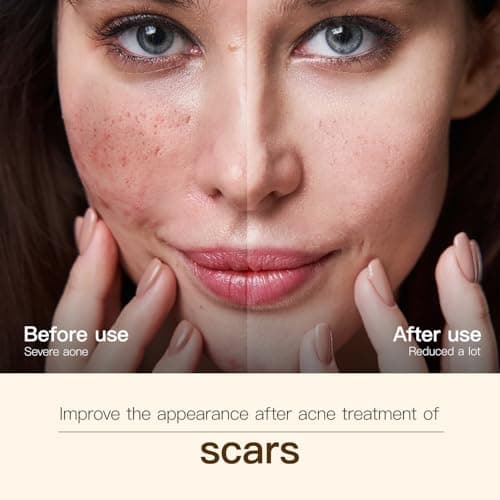 UWPU-Frankincense Oil, Frankincense Oil for Face, Natural Extraction of Bakuchiol, Reduce Wrinkles, for Scars, Gentle Skincare for Day & Night Cold Extracted Facial Oil, for all Skin Types - Thumbnail 5